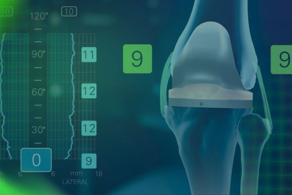 Beyond Precision: Advancing Personalized Total Joint Surgery